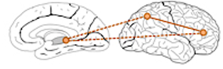 How does attention work in the brain? – neuropedagogy